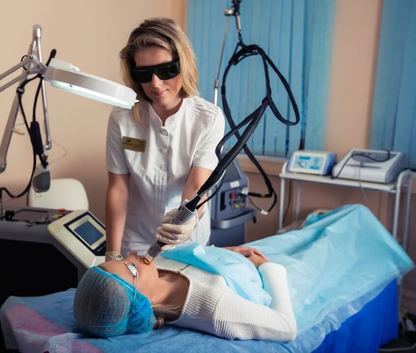 Laserski aparati za podmlađivanje lica
